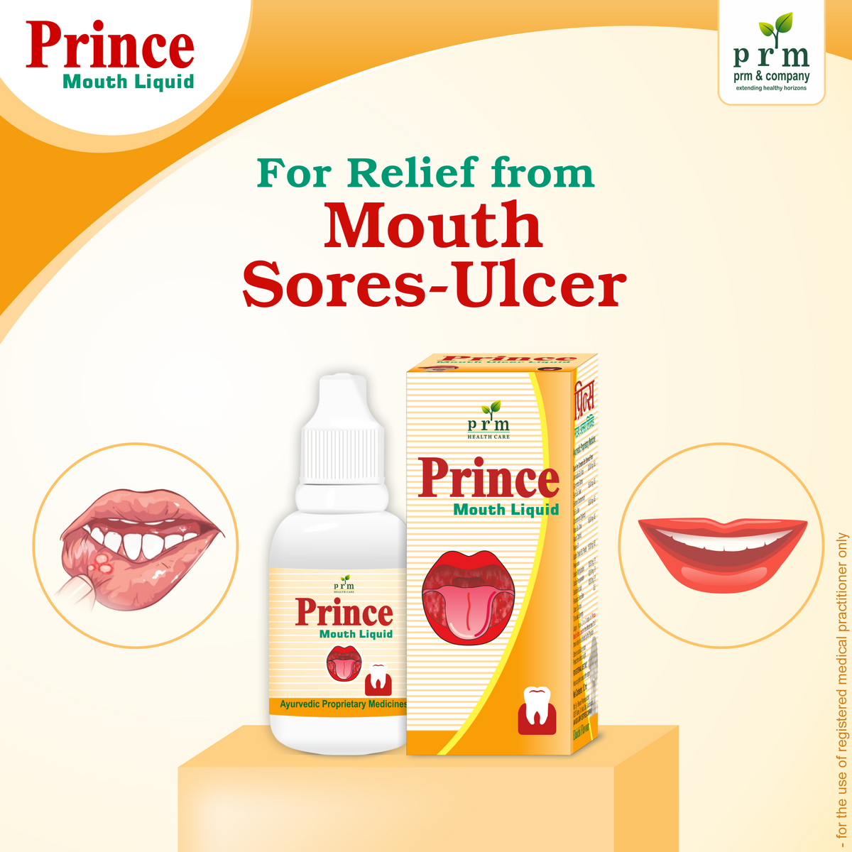 Prince Mouth Liquid πΏ | Ayurvedic Mouth Ulcer Relief Liquid | Herbal Oral Care for Mouth Sores, Tooth Pain & Thrush( Pack of 4)